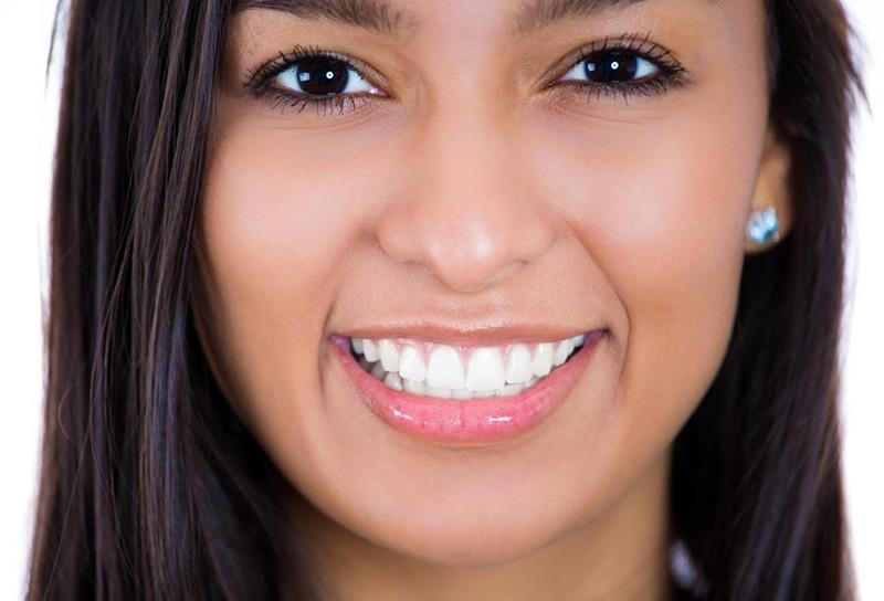 Teeth Whitening